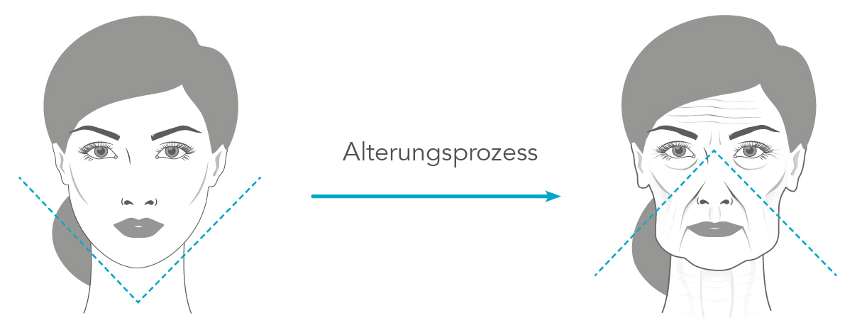 der alterungsprozess schematisch an 2 gezeichneten gesichtern dargestellt