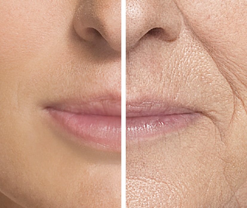 Vergleich von Lippen. junge lippen links, alte lippen rechts